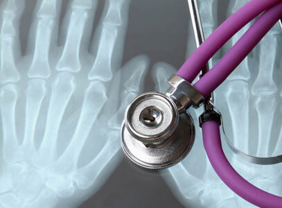 X-Ray and Radiation Facts Image
